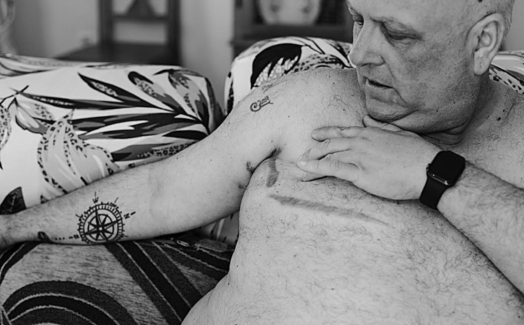 Imagen principal - El hecho de que sea una dolencia infrecuente en hombres no ha impedido que Chema García luche por visibilizar la enfermedad