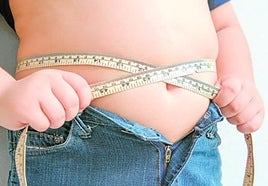 La pandemia de la obesidad: «Tengo niños con 12 años que pesan 100 kilos»
