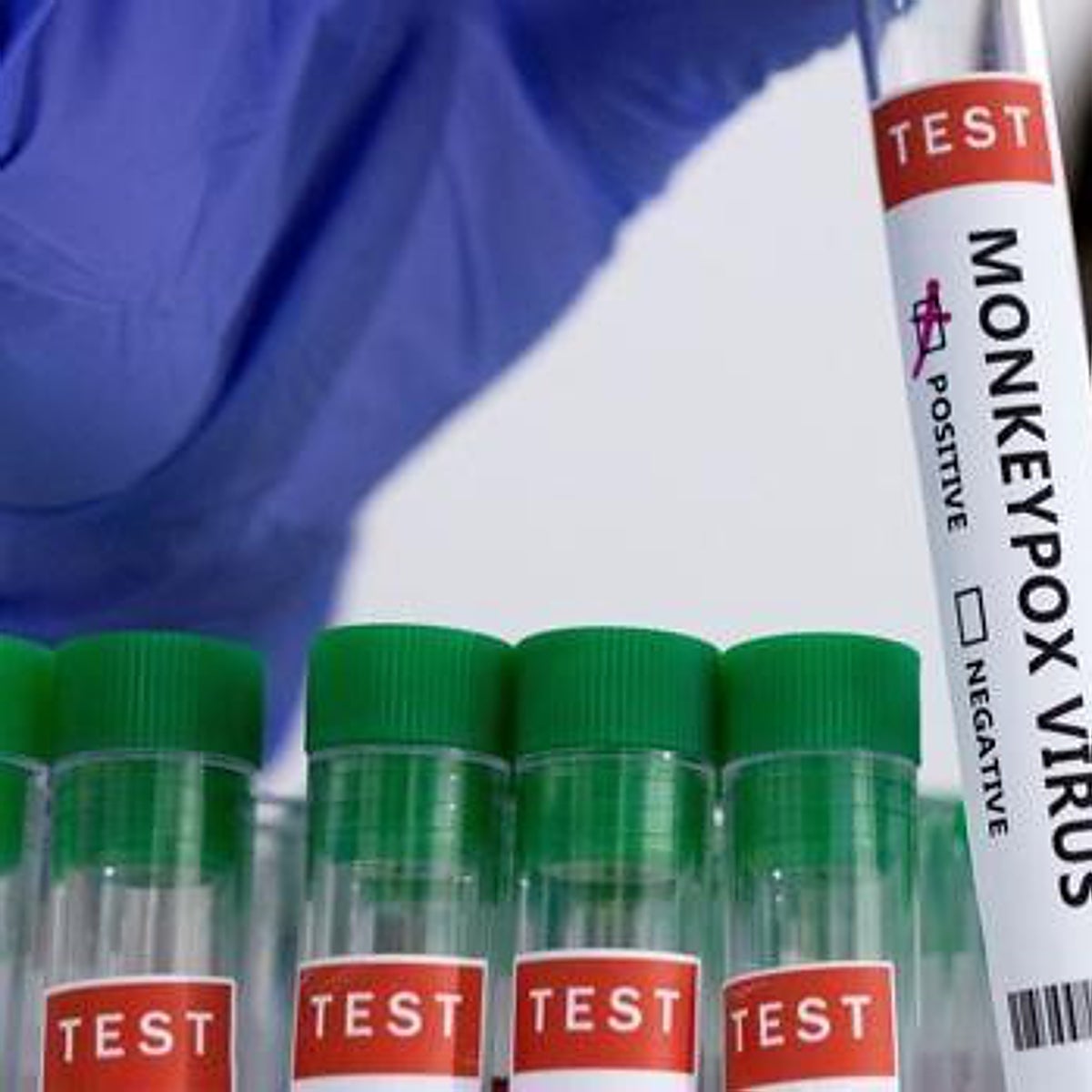 Viruela del mono y Covid: estas son las diferencias entre las dos emergencias sanitarias