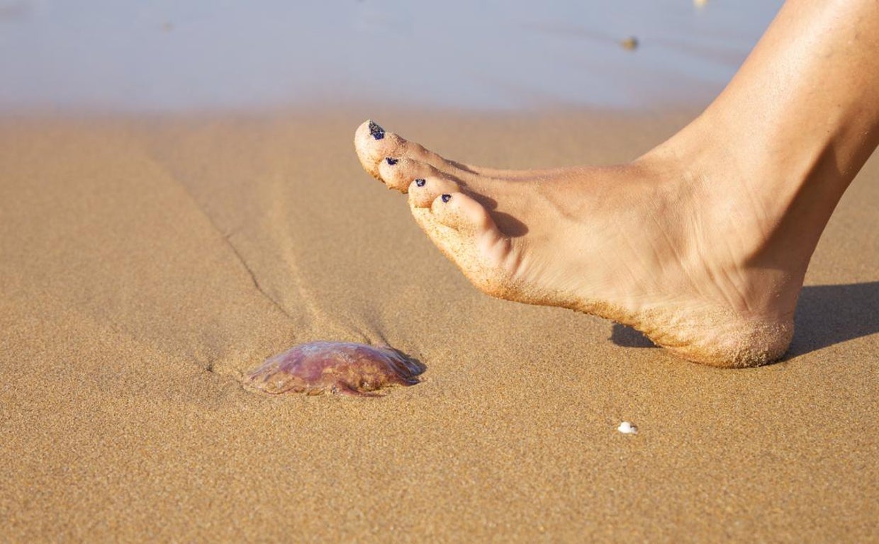 Estos son algunos consejos que debes seguir si sufres una picadura de medusa este verano