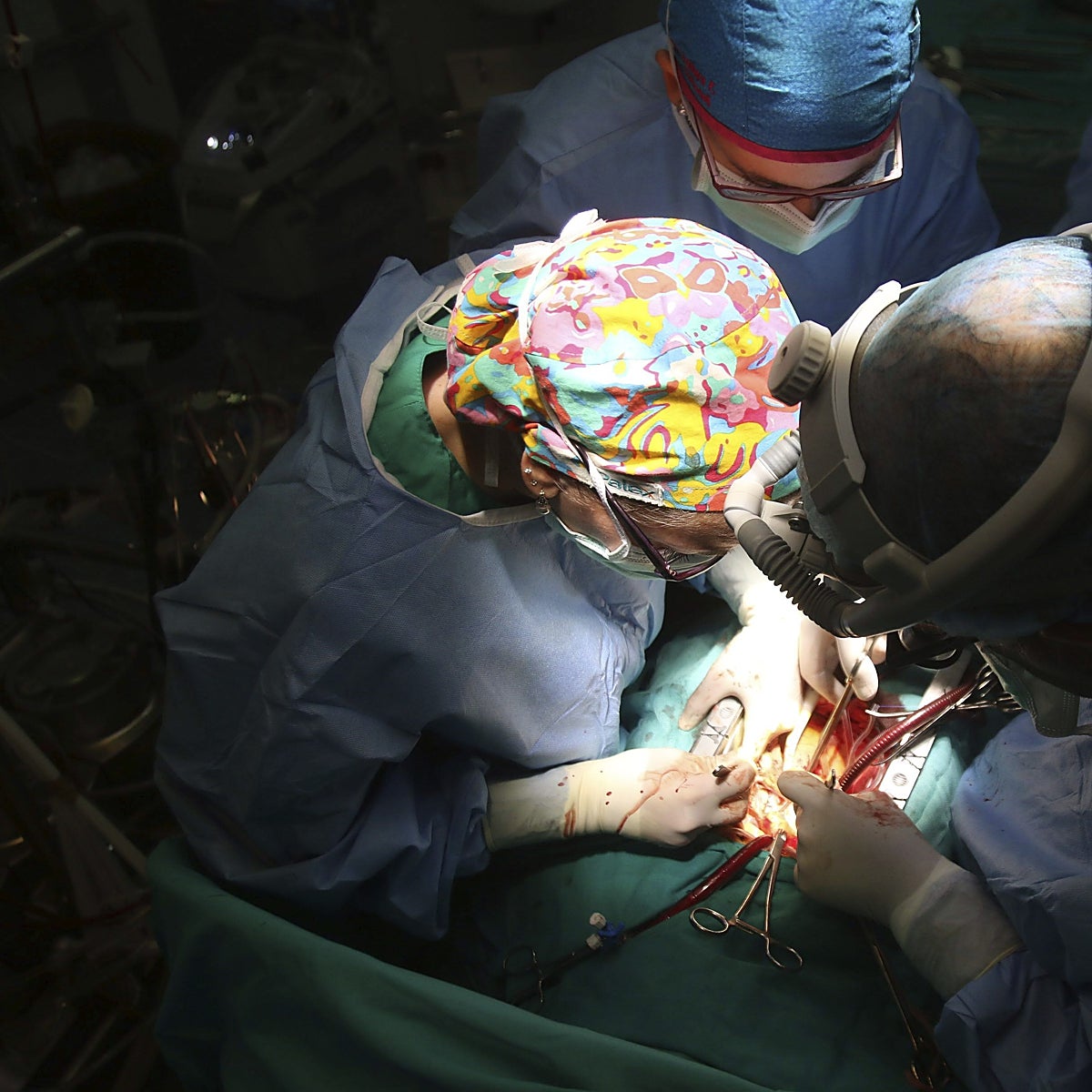 Muere un hombre de 49 años tras trasplantarle por error un riñón que tenía cáncer