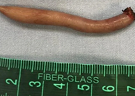 Imagen secundaria 1 - Imágenes de la cola de la bebé de México