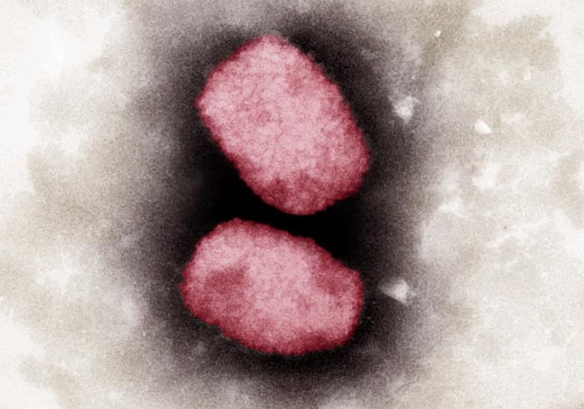 Imagen al microscopio del virus de mpox o viruela del mono