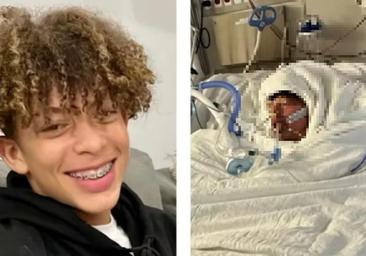 Un adolescente en estado grave y con el 80% de su cuerpo quemado por un reto de TikTok