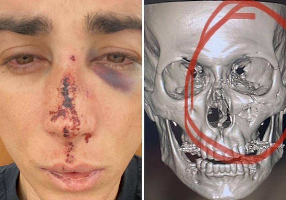 Las secuelas de la agresión de Divino