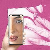 Pasar por quirófano para parecerse a un filtro de Instagram