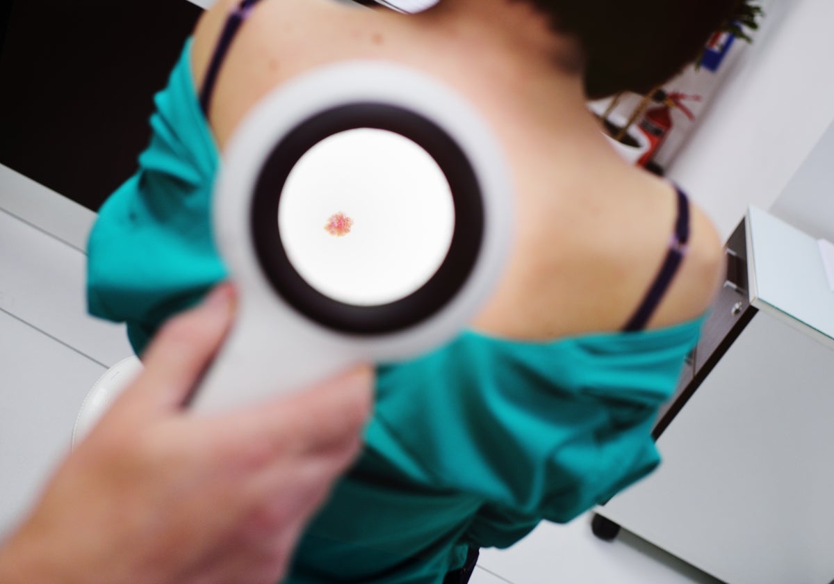 Un dermatólogo examina a una paciente que sufre melanoma