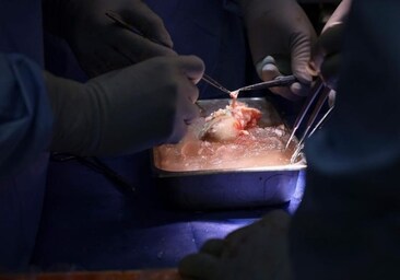 «La diálisis quedará obsoleta»: entusiasmo tras el primer trasplante de un riñón de cerdo a un paciente vivo