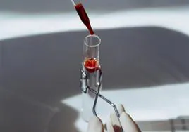 Análisis de sangre para comprobar la coagulación de un enfermo