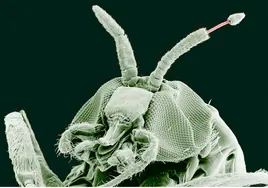 La imagen muestra una mosca negra y a un parásito que surge de su antena