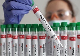 La OMS aprueba el primer test para diagnosticar la mpox