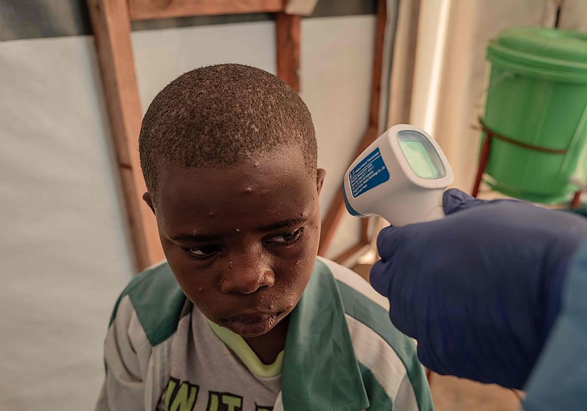 Un médico toma la temperatura a un paciente de viruela del mono en República Democrática del Congo
