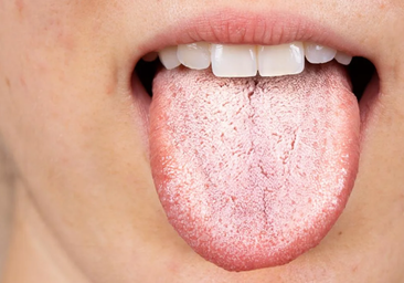 El doctor Alexandre Olmos explica cómo la lengua puede revelar un problema común de salud