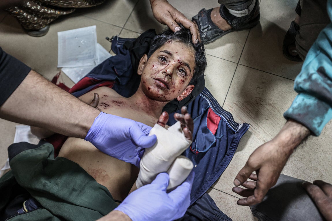 Un niño herido es atendido en el Hospital al-Aqsa, Deir al-Balah, tras un ataque israelí contra el campo de refugiados al-Maghazi. La población del campo se triplicó en los primeros meses de la guerra
