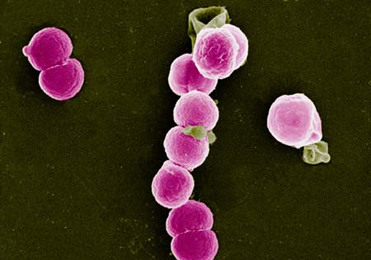 Imagen al microscopio de la bacteria que causa la infección, la Neisseria gonorrhoeae