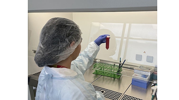 Método pionero para detectar la endometriosis en sangre menstrual : «Reduce de años a semanas la llegada del diagnóstico»