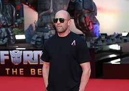 Injerto capilar: cuidados y consejos a tener en cuenta antes de la intervención