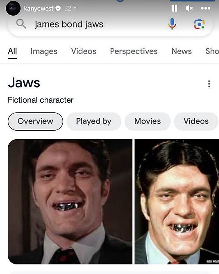 El rapero se inspira en el villano de James Bond para lucir una dentadura.