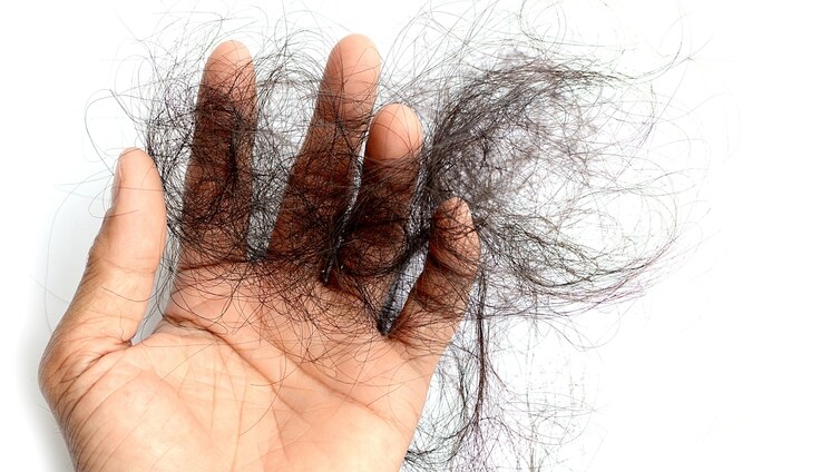 Caída del pelo en primavera: ¿qué funciona para frenarla?