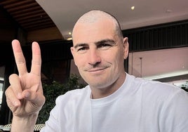 ¿Es necesario raparse para hacerse un injerto capilar?