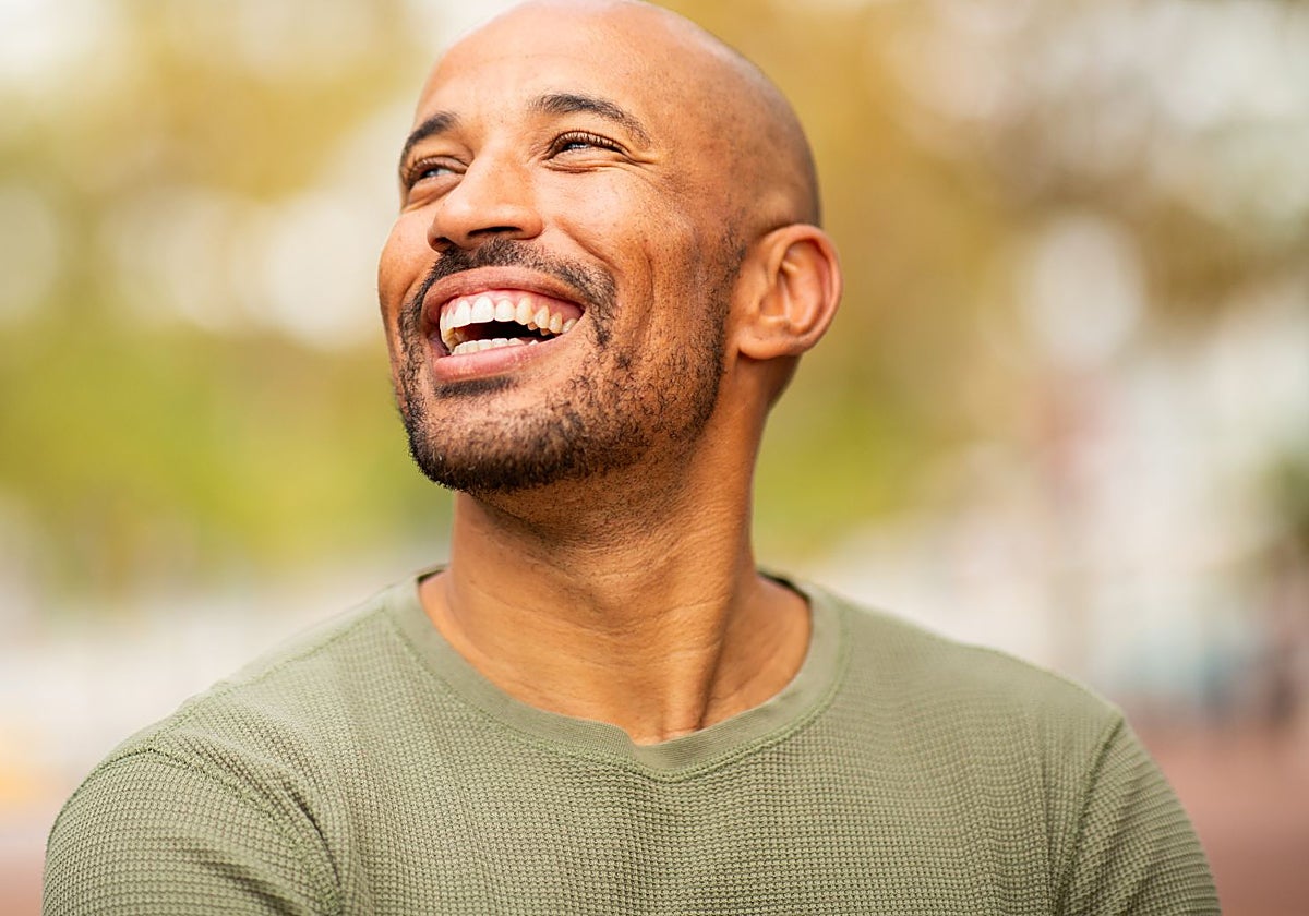 La calvicie afecta a un gran número de hombres.