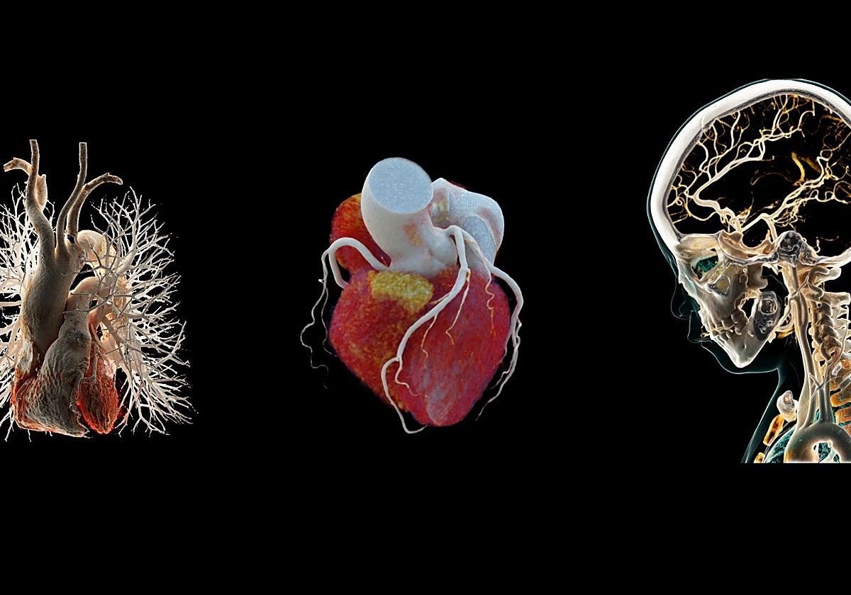 De izquierda a derecha, gemelos digitales de los pulmones, corazón y cerebro, desarrollados por Siemens Healthineers para estudiar y prevenir enfermedades
