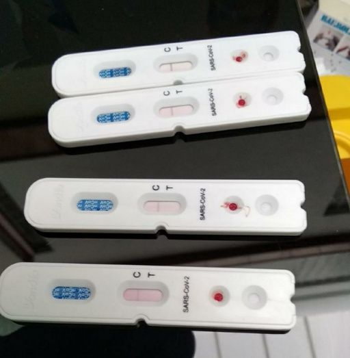La Junta realizará 7.500 test rápidos a todos los profesionales de los hospitales y centros de salud de Huelva