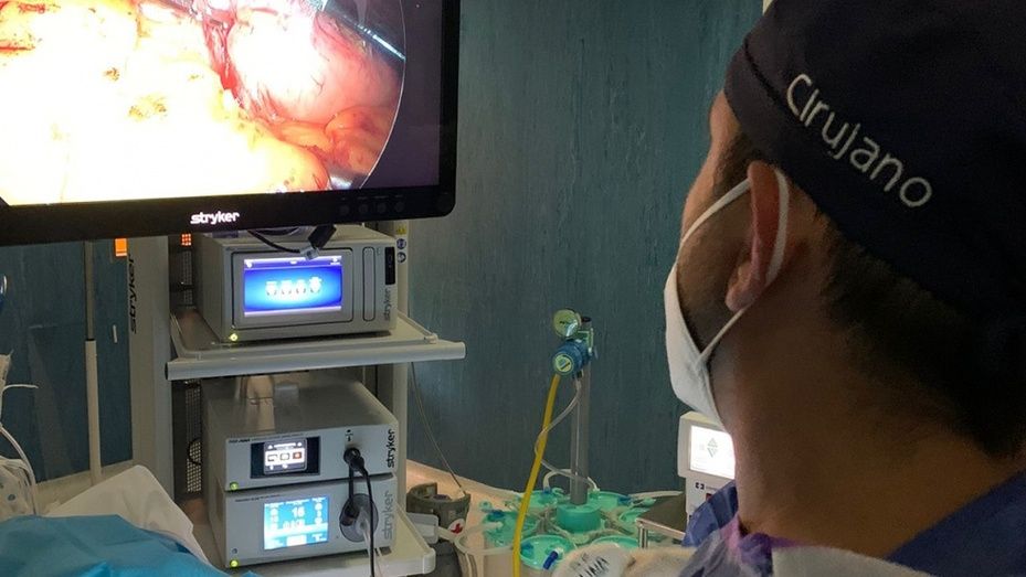 Manga gástrica: experto de Quirónsalud Huelva destaca la alta tasa de éxito en pacientes obesos intervenidos mediante esta técnica