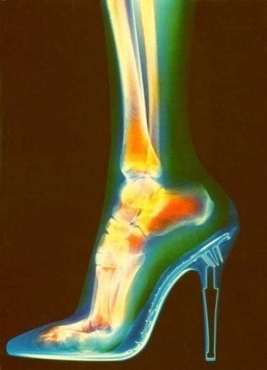 Tacones... pero con cuidado