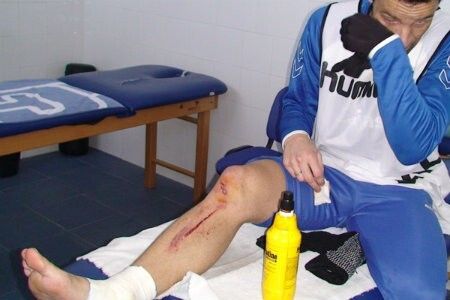 Arana es duda para Murcia al sufrir una herida en la tibia y la rodilla