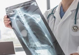 La UHU y el Juan Ramón Jiménez participan en una investigación sobre el cáncer de mayor mortalidad