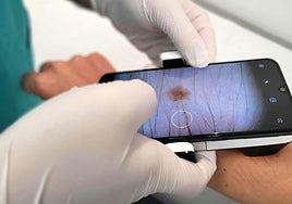 Una clínica de Huelva ofrece pruebas diagnósticas gratuitas para revisar el estado de la piel tras el verano