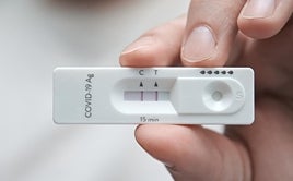 Un test de Sars-CoV-2