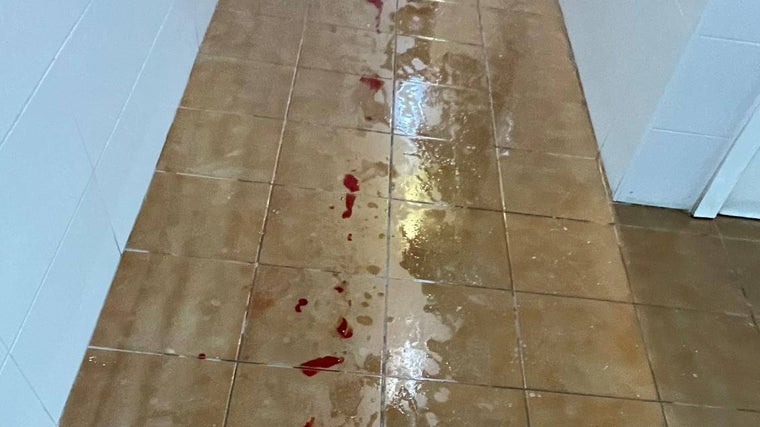 La chapa de aluminio actuó como una guillotina.