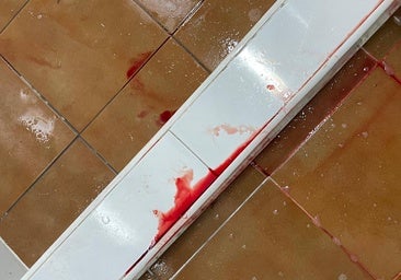 Grave accidente de un niño en el torneo Futsal Cup de Cádiz: más de 70 puntos de sutura y un mes de reposo
