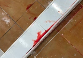 Grave accidente de un niño en el torneo Futsal Cup de Cádiz: más de 70 puntos de sutura y un mes de reposo