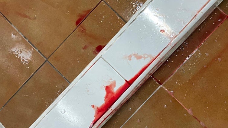 Grave accidente de un niño en el torneo Futsal Cup de Cádiz: más de 70 puntos de sutura y un mes de reposo