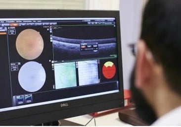 Uno de cada tres afectados por glaucoma en Cádiz no sabe que lo padece