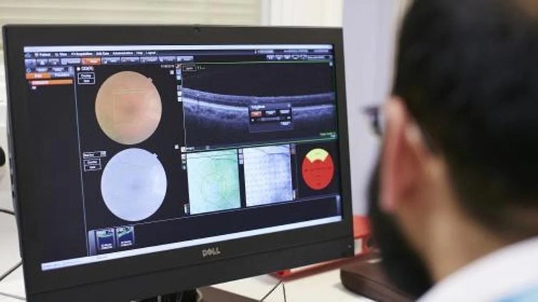 Uno de cada tres afectados por glaucoma en Cádiz no sabe que lo padece