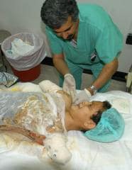 El pequeño Alí, examinado por un cirujano plástico, tras su traslado a Kuwait REUTERS