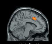En un círculo, la zona cerebralactivada por un sentimiento de rechazo. SCIENCE