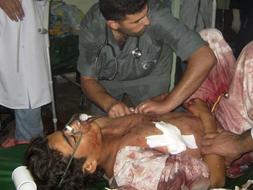 Los servicios médicos tratan a uno de los heridos en un atentado perpetrado hoy. /AP