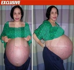 Los octillizos, en perfecto estado de salud