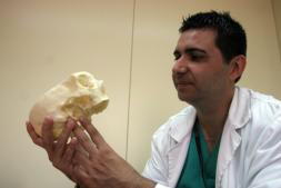 «Hay trasplantados de cara que parecen Frankenstein por la ambición del cirujano»