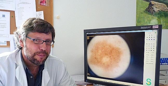 Llega la Teledermatología