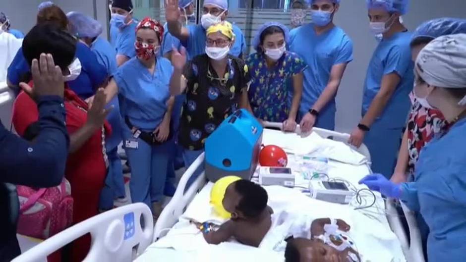 Separan con éxito a las siamesas de Camerún unidas por la columna vertebral y la cadera