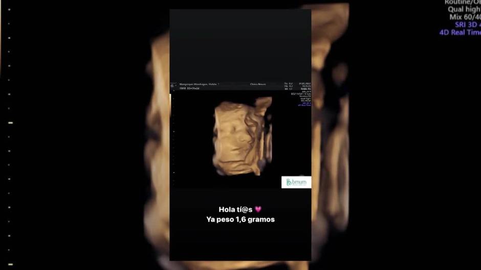 Violeta Mangriñán desvela la cara de su hija gracias a una ecografía 3D