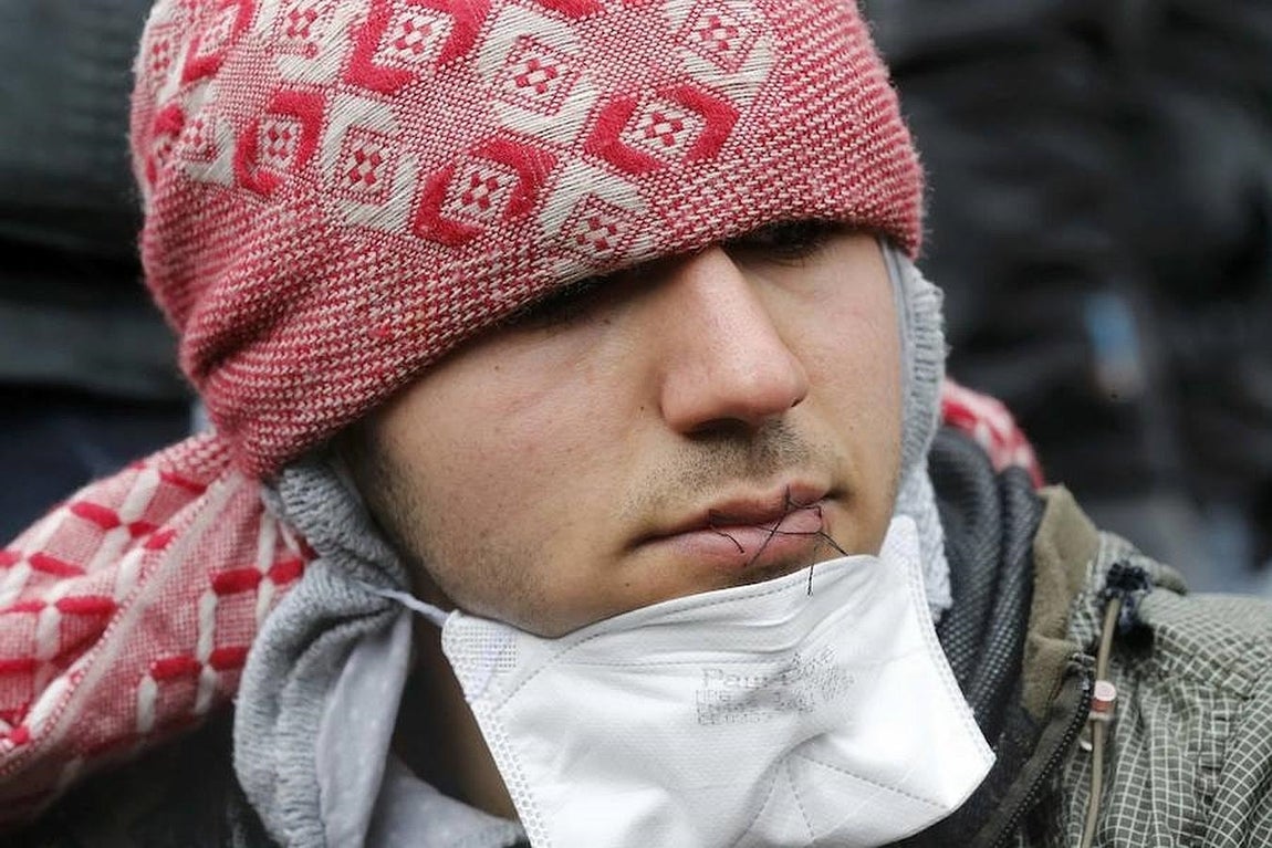 En los dos primeros días de trabajo se habían desmantelado las chabolas que había en unos 15.000 metros cuadrados de la parte sur del campamento de inmigrantes de Calais. 