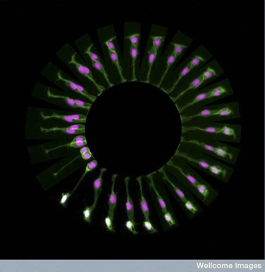 Células madre en división en el cerebro. 