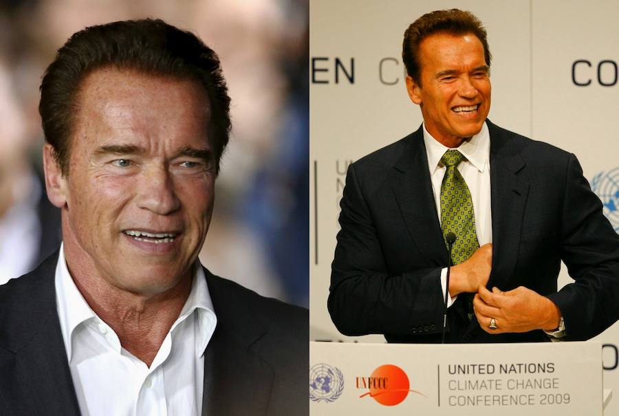 Arnold Schwarzenegger se ha sometido a un «lifting» para estirar su piel y al botox para marcar más sus pómulos. 